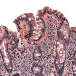 Coeliac_path